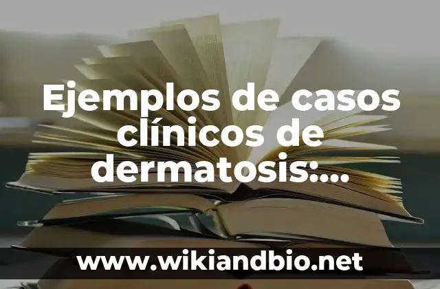 Ejemplos de casos clínicos de dermatosis: Definición según Autor, qué es, Concepto y Significado