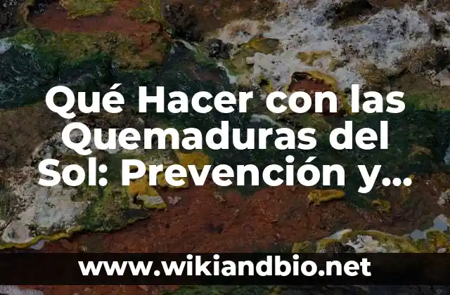 Qué Hacer con las Quemaduras del Sol: Prevención y Tratamiento