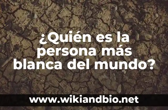 ¿Quién es la persona más blanca del mundo?